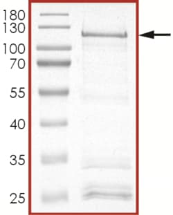 Sino Biological&nbsp;Recombinant Human IRS1 Protein (C-Term, GST Tag)